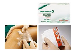 MEDICAZIONE STERILE IN FILM IN POLIURETANO TRASP. SUPRASORB F 10X12CM 10 PEZZI - Gruppofarmastore.it